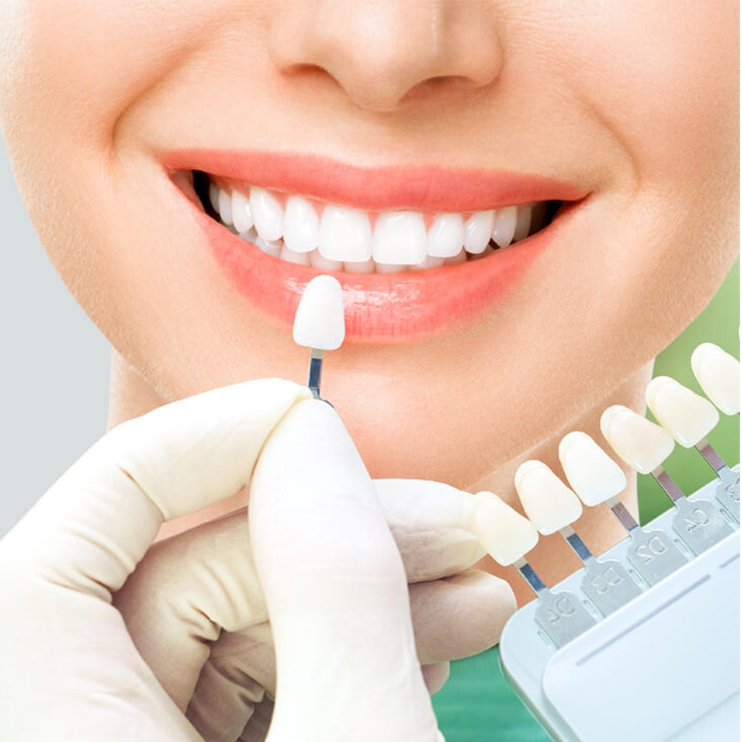 Dental
