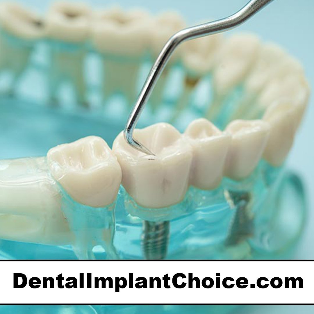 dentalimplantchoice.com