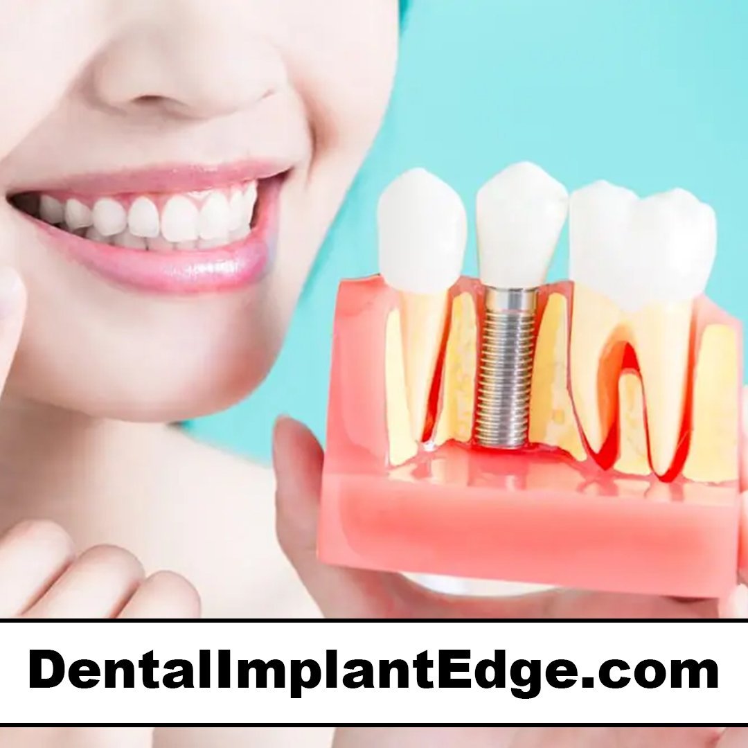 dentalimplantedge.com