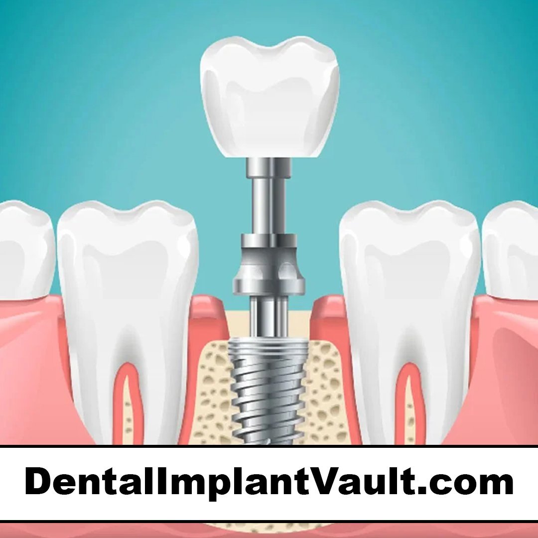 dentalimplantvault.com