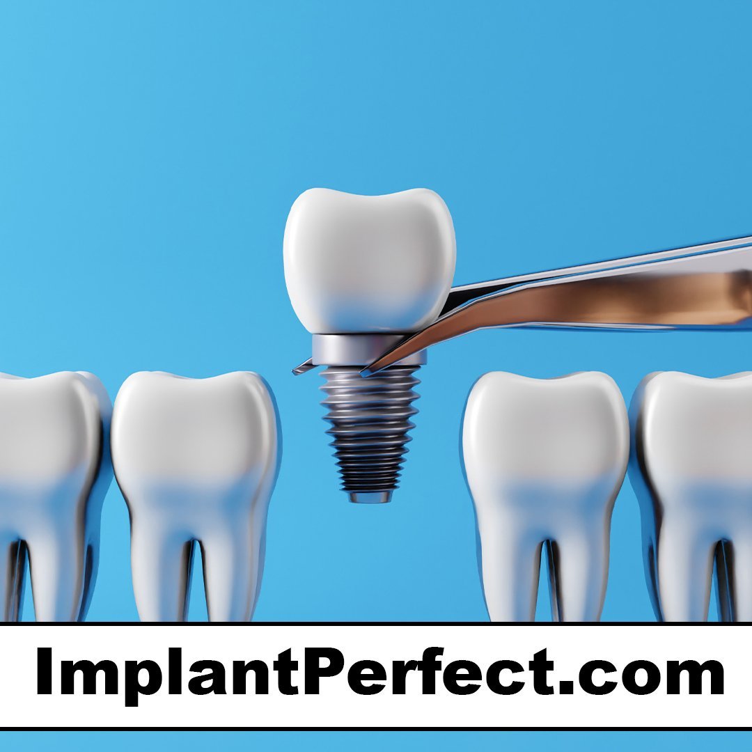 implantperfect.com