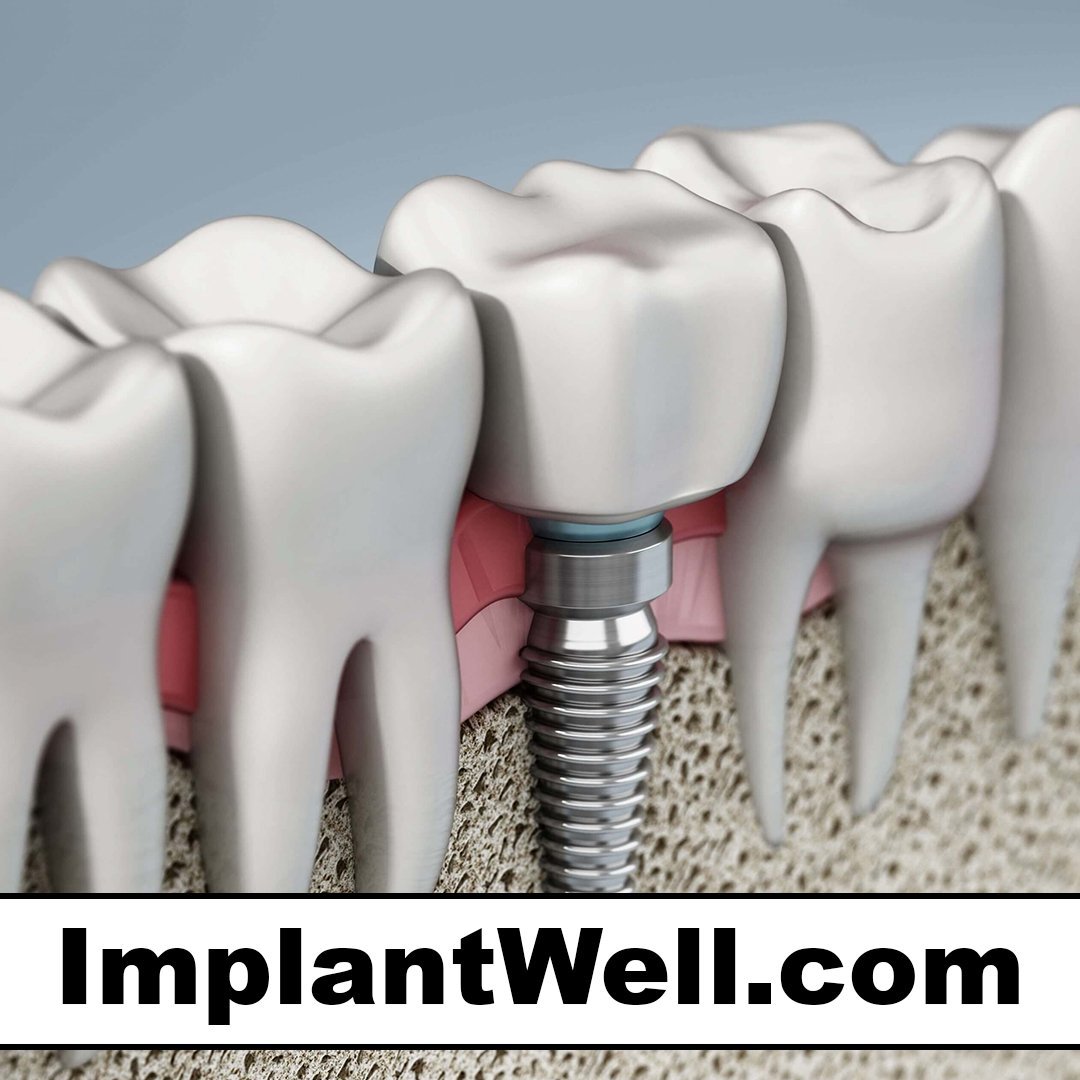 implantwell.com