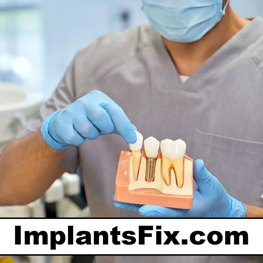implantsfix.com