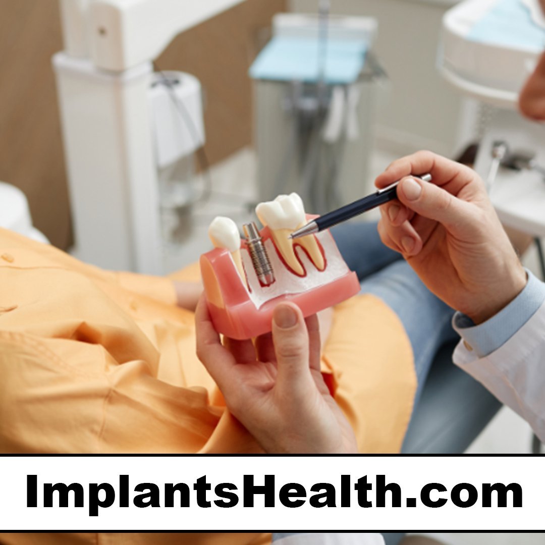 implantshealth.com