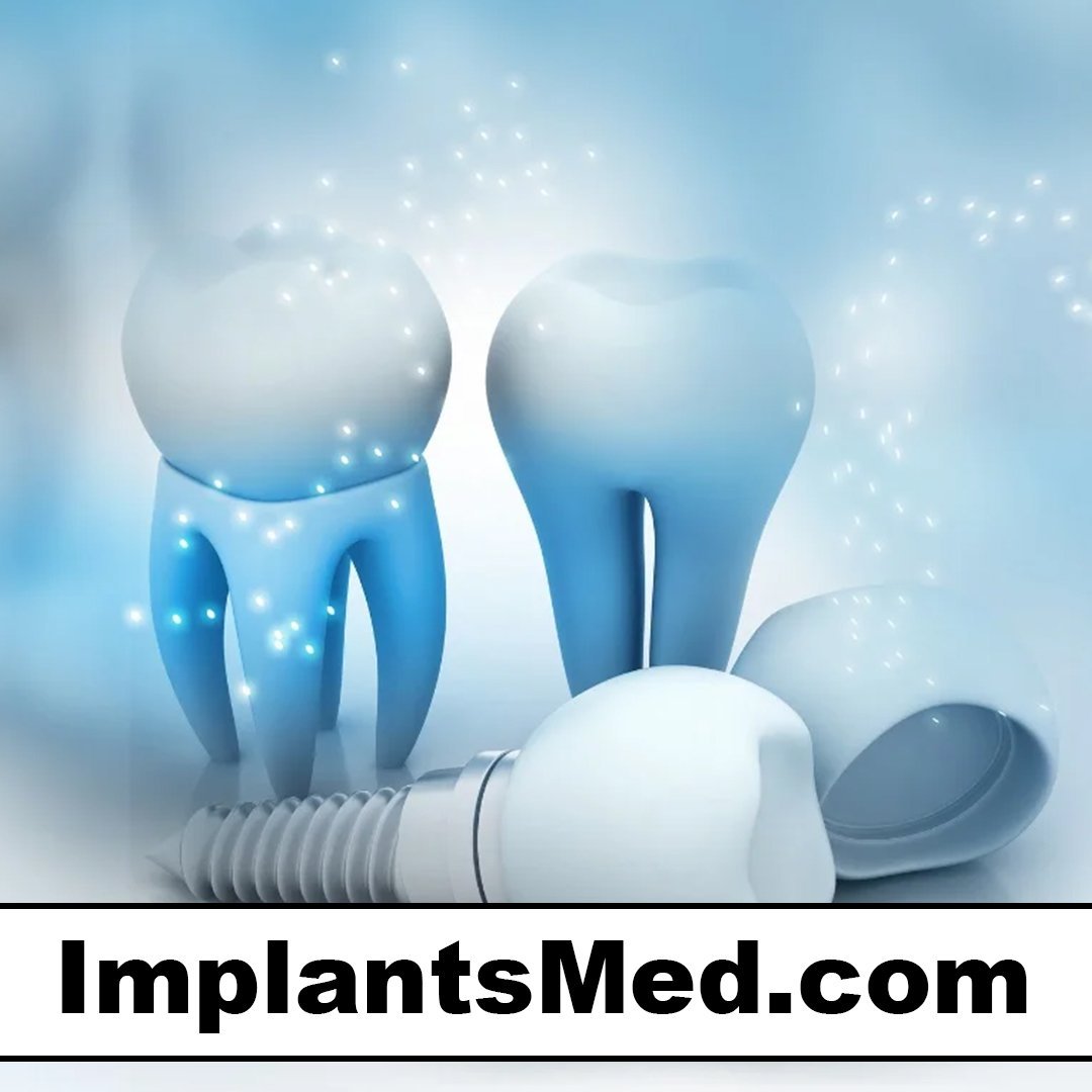 implantsmed.com