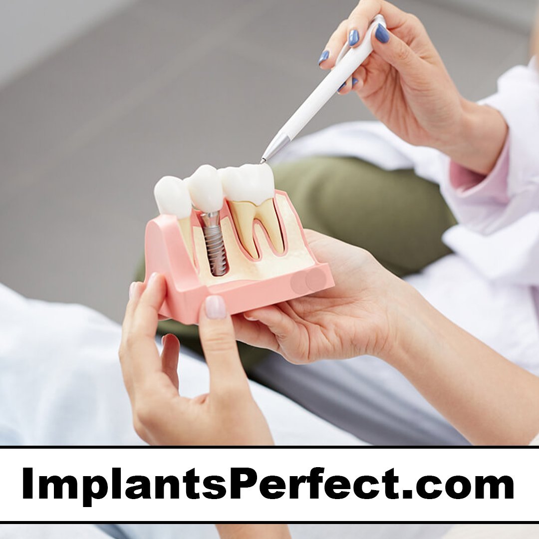implantsperfect.com
