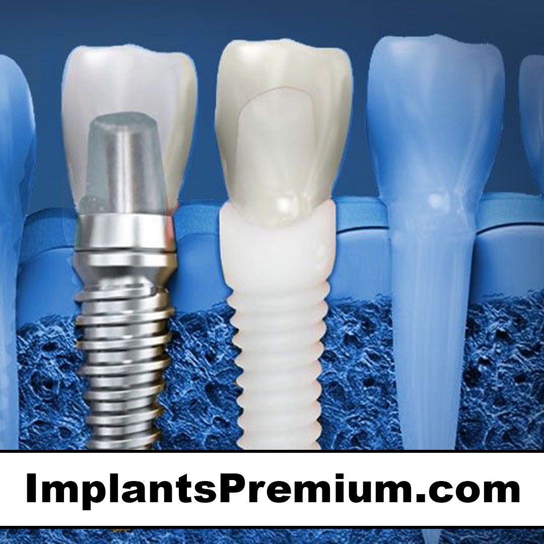 implantspremium.com