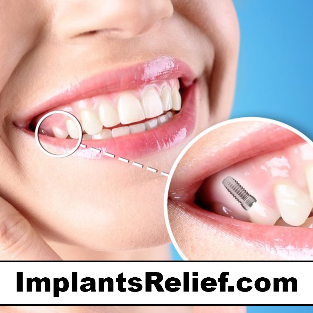 implantsrelief.com