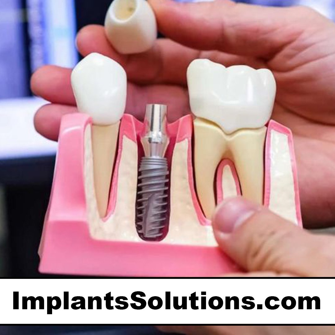implantssolutions.com