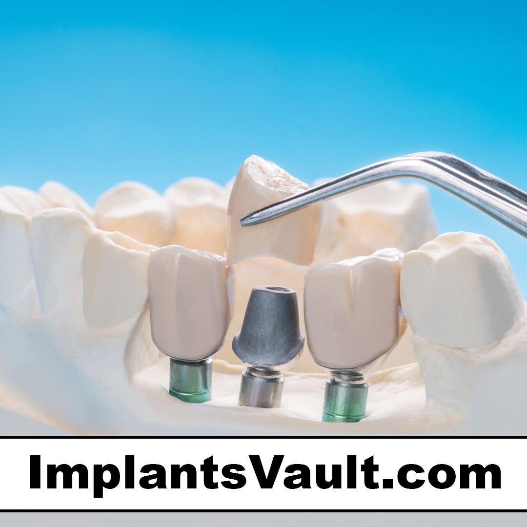 implantsvault.com