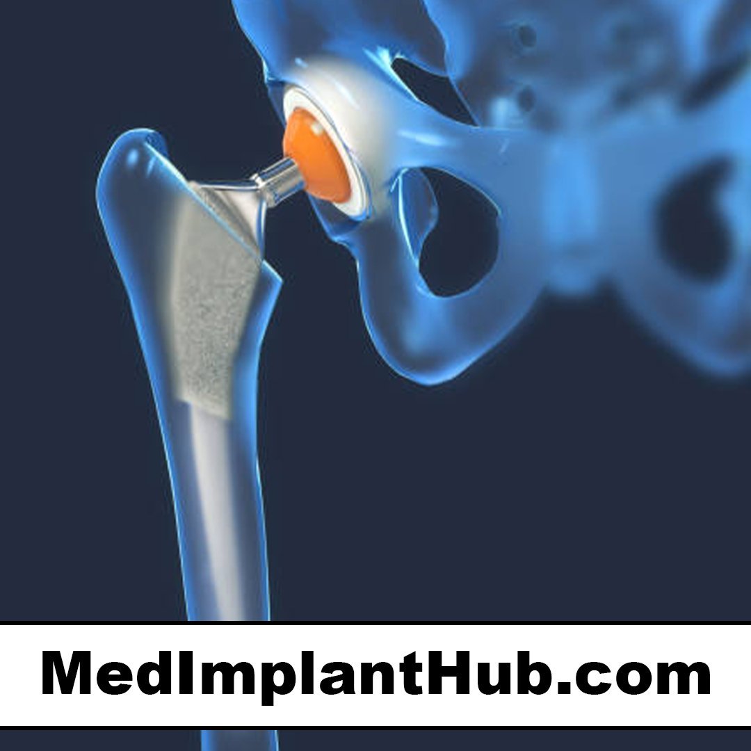 medimplanthub.com