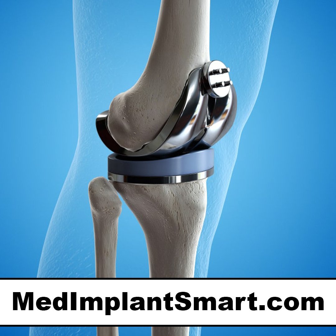 medimplantsmart.com
