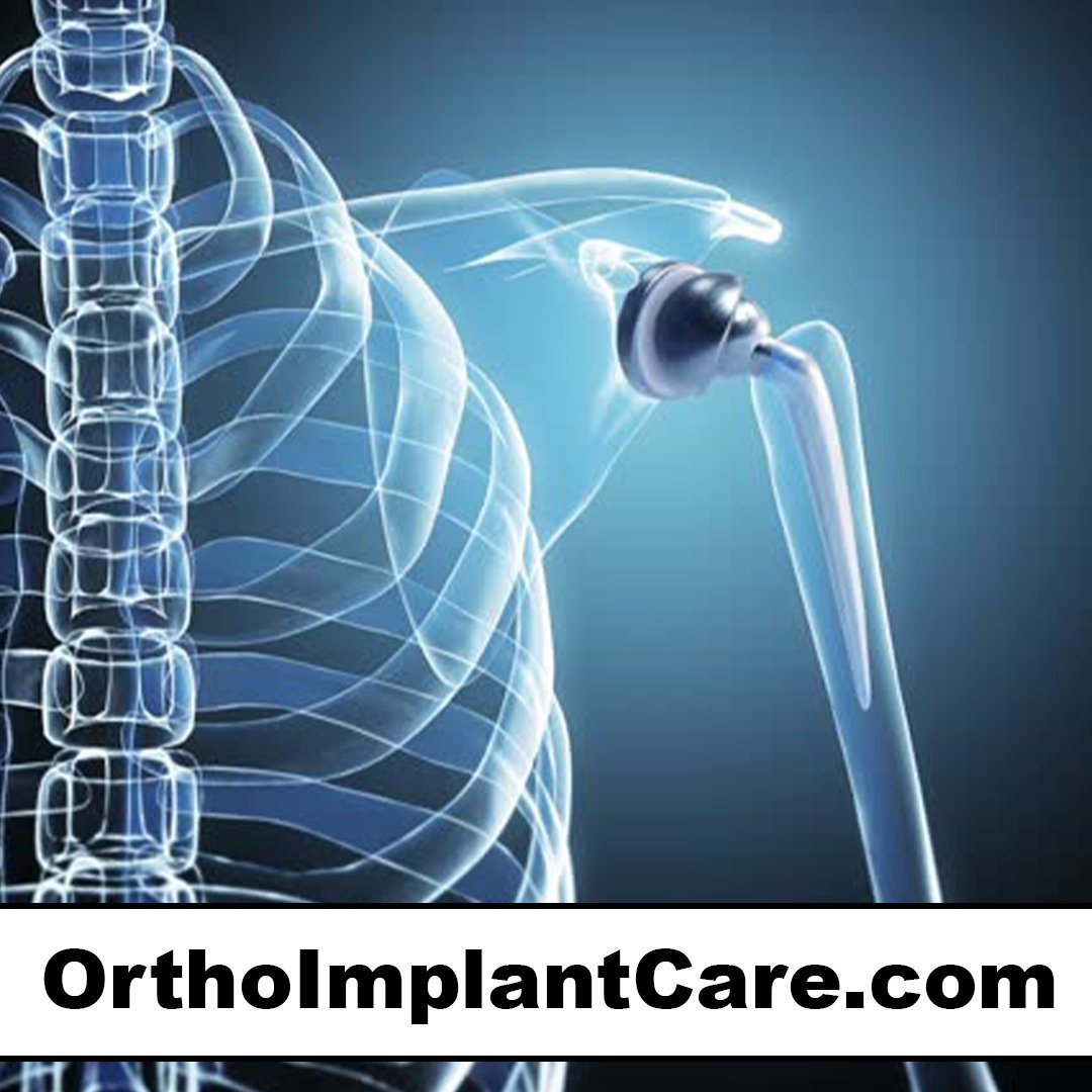orthoimplantcare.com