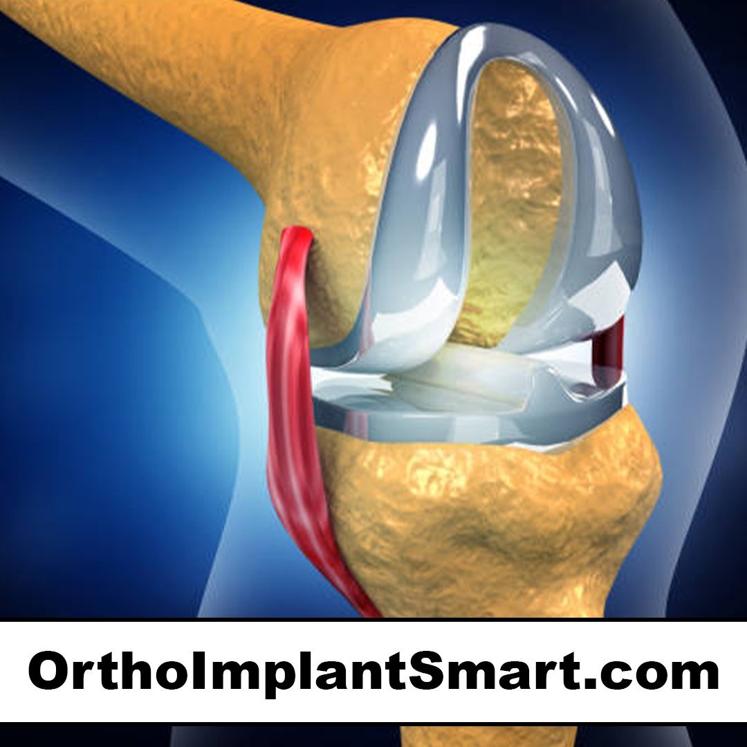 orthoimplantsmart.com