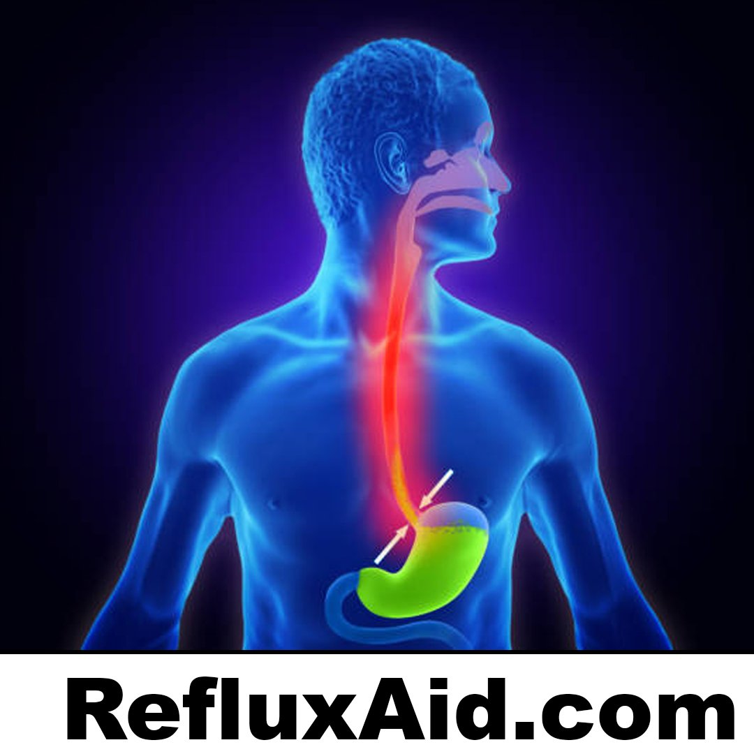 RefluxAid.com