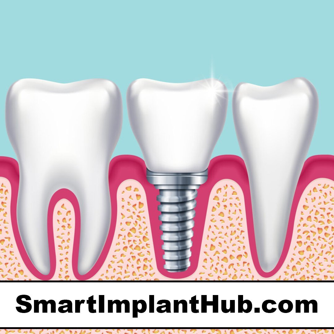 smartimplanthub.com