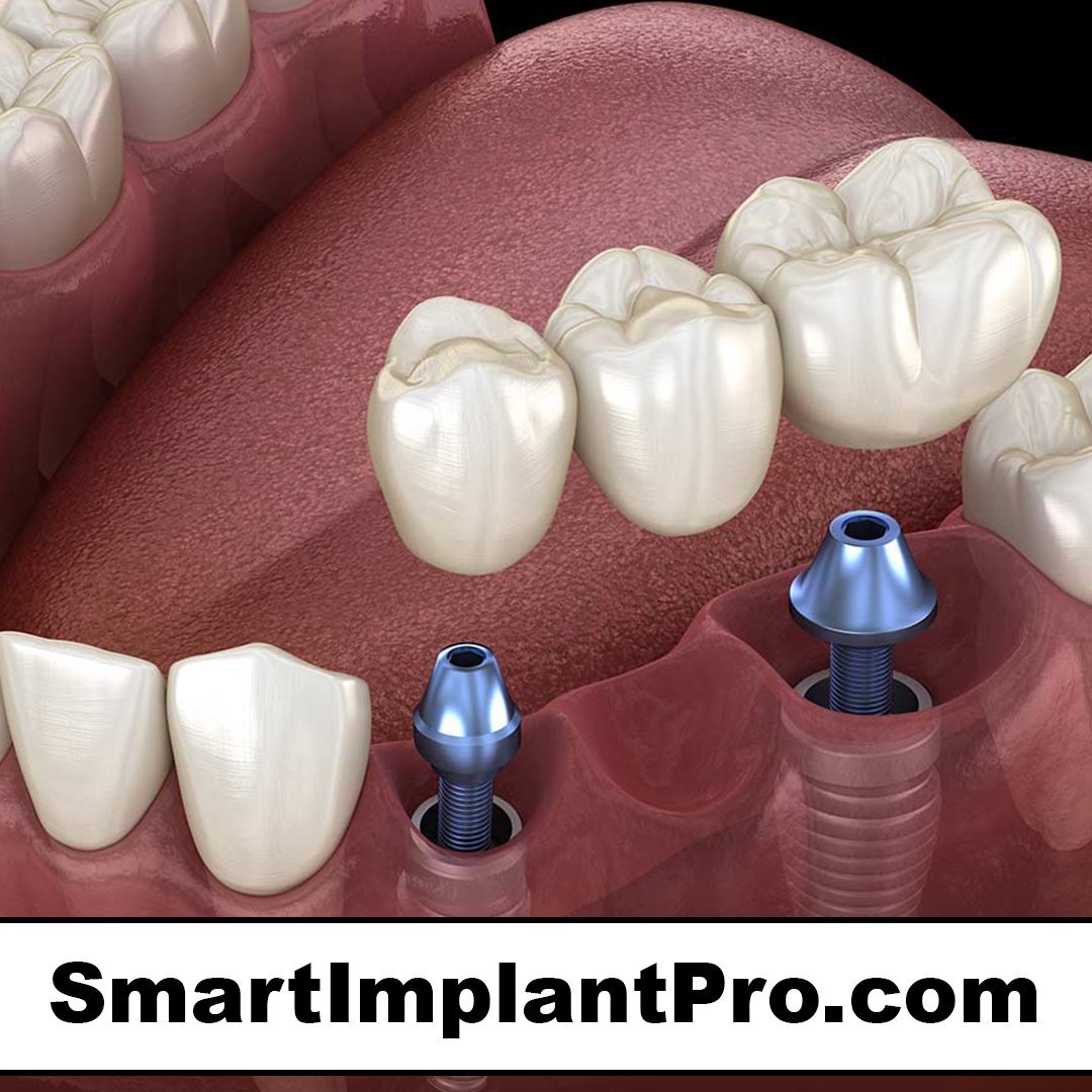 smartimplantpro.com